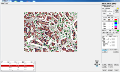  DB-3000顯微圖像分析軟件/生物圖像分析軟件/細(xì)胞統(tǒng)計軟件